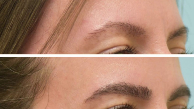 How to Grow Eyebrow thick and Fast?