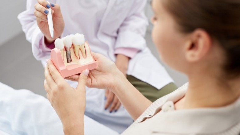 Is Bone Grafting Always Necessary Before Dental Implantation?