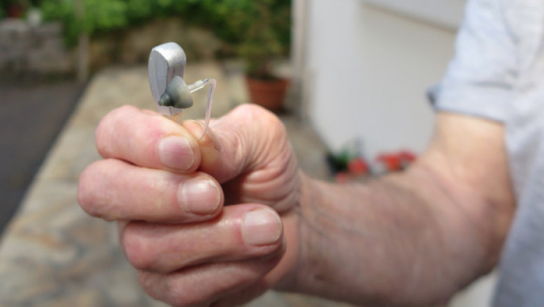 Cochlear implants, bone-anchored hearing systems, and FM systems are examples of audiology devices that can be used to diagnose and treat ear problems