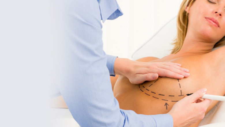 Breast reduction surgery in Delhi