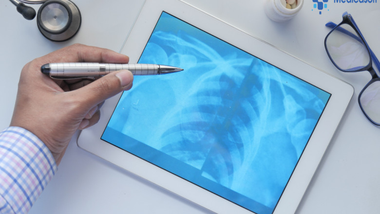 The Power of the Next Generation of RIS | Medicasoft