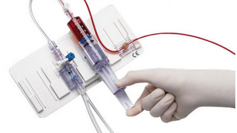 Closed Blood Sampling System Require Less Blood, thus Ultimately Causing Less Blood Loss in Patients