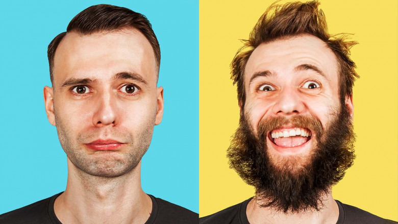 Restore Your Beard, Sideburns with a Facial Hair Transplant