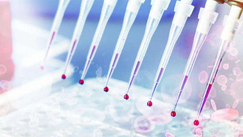 Blood screening tests have become increasingly important in the diagnosis of a wide range of diseases, such as HIV/AIDS, high cholesterol, and cancer