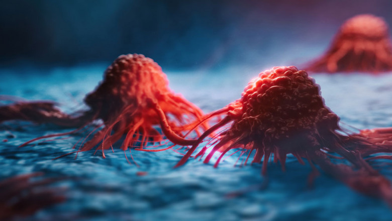 What is tumor/cancer profiling? What are the different kind of profiler utilized simultaneously?