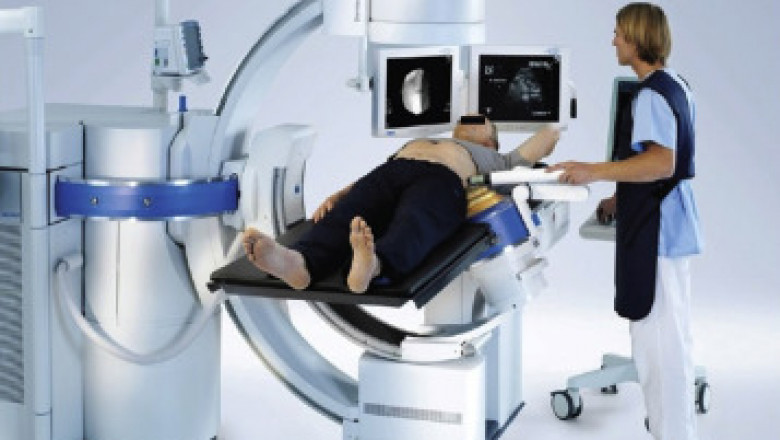 Why lithotripsy devices is acquiring noticeable quality in the medical care industry?