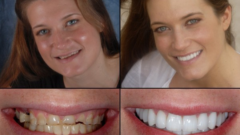 Northern Virginia Orthodontics