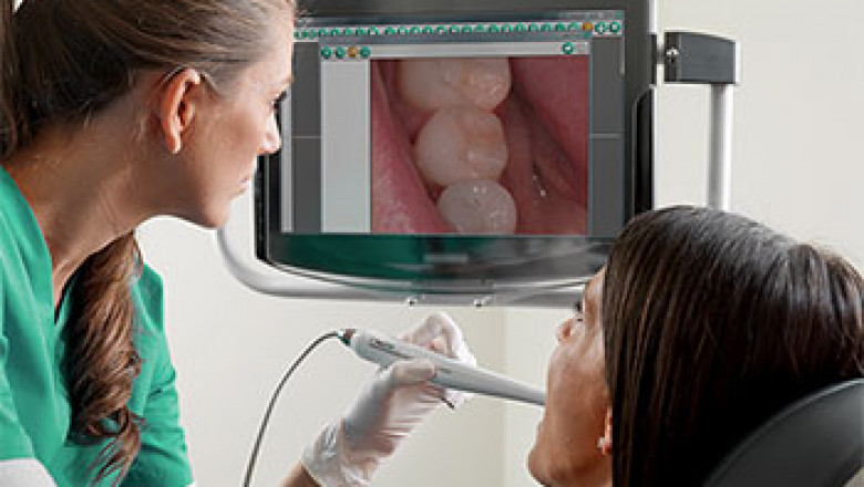 Dental Camera Is A Small Camera That Takes An X-Ray Of The Tooth Or Gums Of Patients