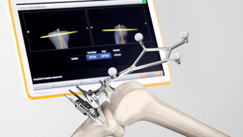 Surgical Preoperative Planning Software Market Growing Trends and Technology Forecast 2021-2030