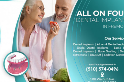 All-on-4 dental implants: 3 distinguishable benefits for an enhanced smile!