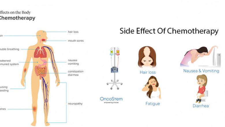 Dos and Don’ts in Chemotherapy | Chemotherapy in Gurugram, Gurgaon, Haryana
