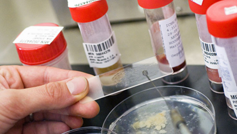 Pneumonia Diagnosis has become more important since the launch of Covid-19, resulting in an increase in demand for Pneumonia Testing.