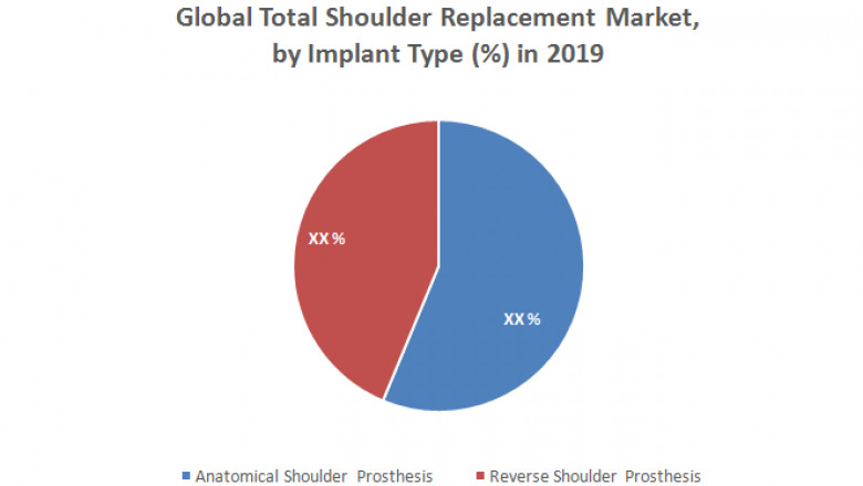 Global Total Shoulder Replacement Market