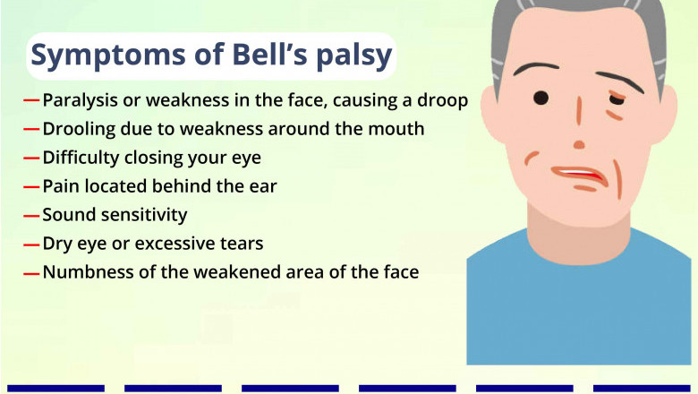 Mini Stroke Treatment in NJ | Complete Neurological Care