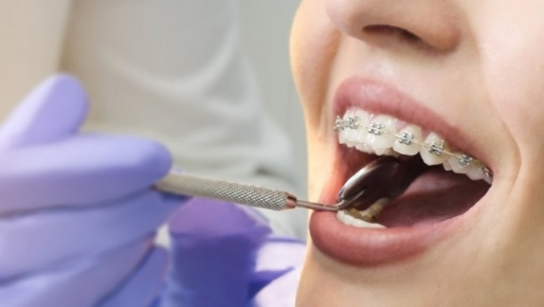 Emergency Dentist Near Los Angeles, CA 90002 | Emergency Dental Service