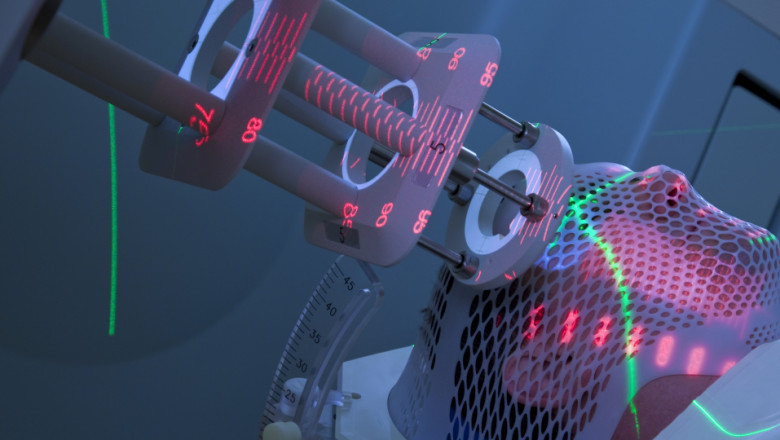 Innovative Developments In Medical Lasers Systems Have Strongly Impacted The Overall Business Growth Over The Recent Years