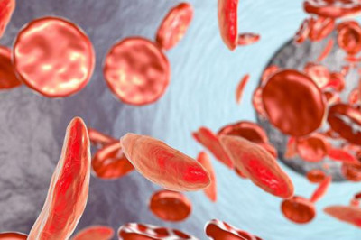 Sickle Cell Anemia Therapeutics Market Size Share Trends Forecast 2026