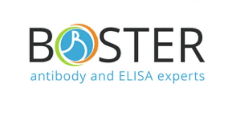 Human VEGF ELISA Kit