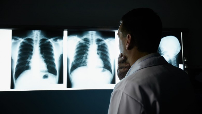 AI-powered X Ray Imaging Market to Witness Astonishing Growth With Siemens Healthineers, Agfa - Gevart Group, Hologic