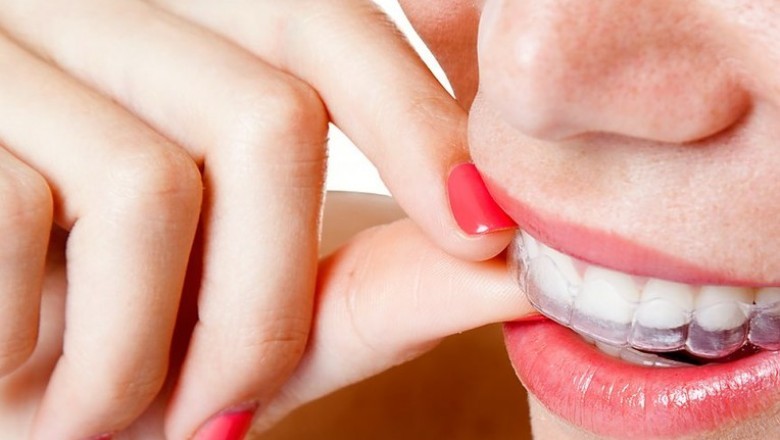 How to Get Maximum Insurance Coverage from Orthodontist in Bensonhurst?
