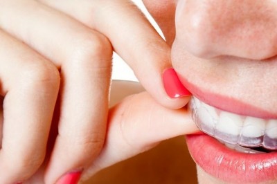 How to Get Maximum Insurance Coverage from Orthodontist in Bensonhurst?