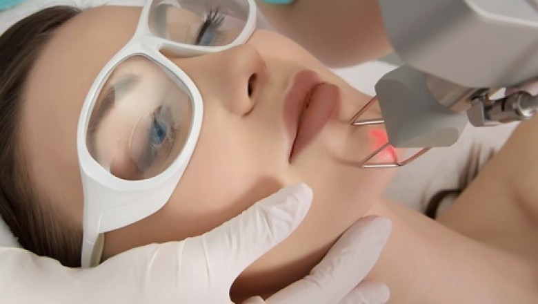 Laser Resurfacing Devices Market is expanding rapidly with Alma Inc. launching the first fractional plasma RF technology Opus to address skin quality concerns
