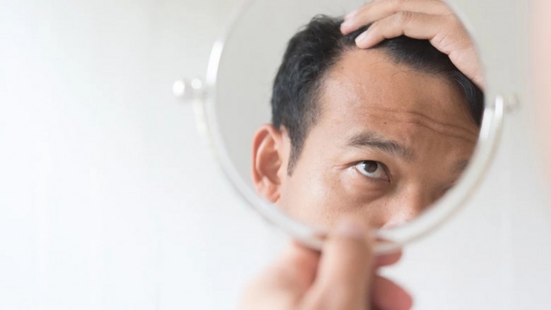 What To Do Before A Hair Transplant?
