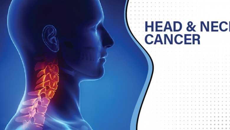 [2021] Head and Neck Cancer Market Deep Insights by MRFR