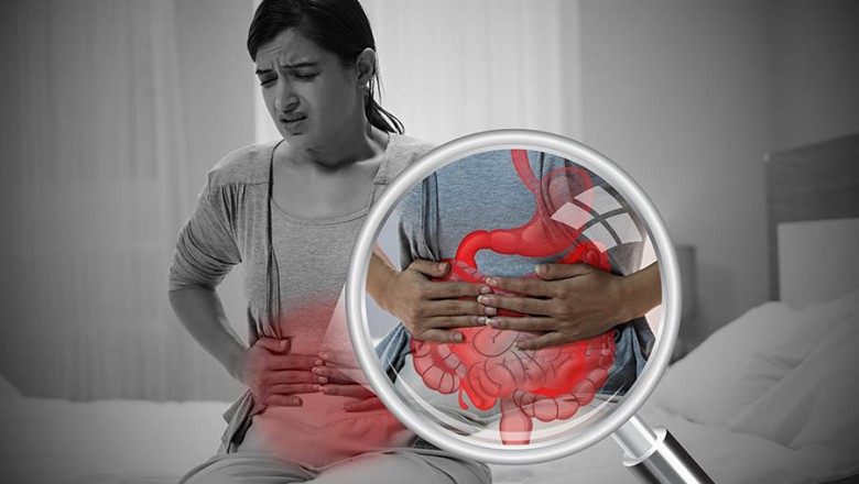 Colonic polyps- All you need to know