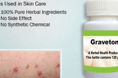 Natural Remedies for Grover’s Disease with Herbal Supplement