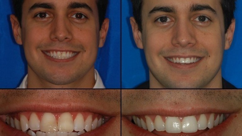 Dentistry Northern Virginia Orthodontics