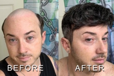 How does a men'sfrontal hairpiece work and who is it for?