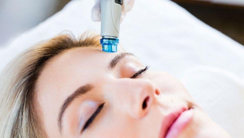 Beauty Dermabrasion Equipment Is Used By Dermatologists To Perform Superficial Scars