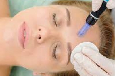 Microneedling facial