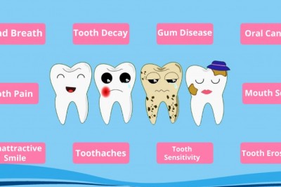 Most Common Dental Problems | Best Emergency Dentist