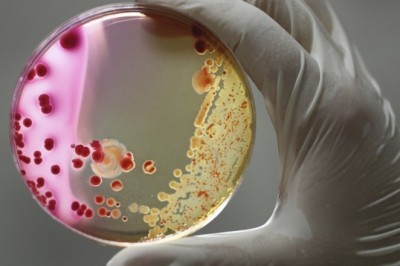 Antimicrobial Susceptibility Testing Market Estimate To Boost Growth In Demand By : Global Forecast, 2026