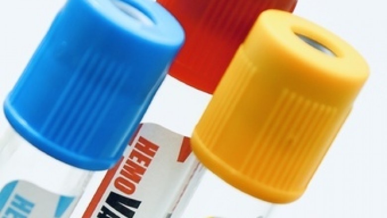 Plasma Blood Collection Tube Market 2020 In-Depth Analysis of Industry Share, Size, Growth Outlook up to 2027 | Smiths Medical (US),Quest Diagnostics (US),Nipro Medical (US),Medtronic (US)