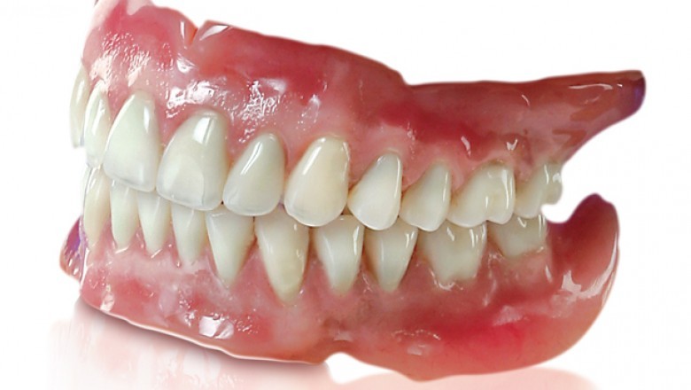 Dentures are still one of the most significant dental prosthesis for avoiding oral bone loss and enhancing natural tooth appearance.