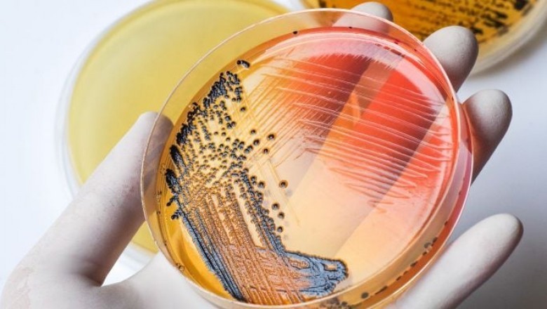 Enteric Disease Testing Market is an emerging market that has accelerated the growth of rapid diseases diagnosis for enteric diseases.