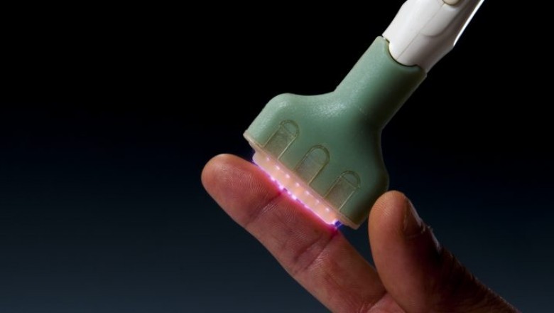 Cold plasma bio-welding Device eliminates much of the physical strain associated with welding