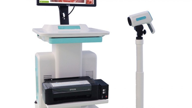 Colposcope Medical Imaging Method Is Used In Coloposcopy to Determine Whether a Woman Has Cervical Cancer and Are Used All Across the World