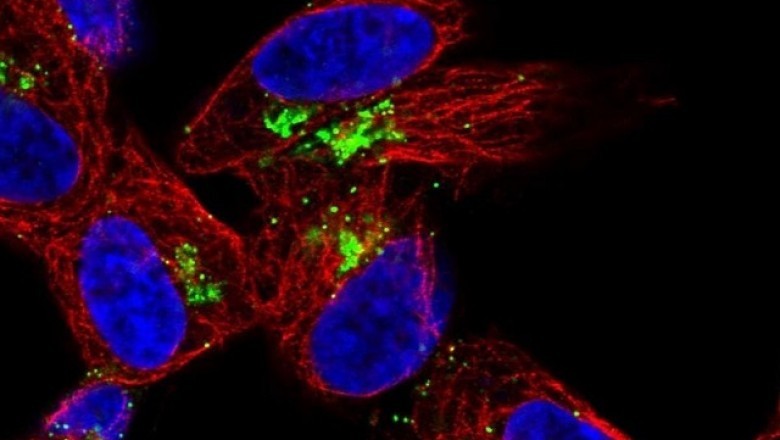 Neuropeptide Y Acetate is emerging as promising diet supplement to treat wide range of neuroligical disease