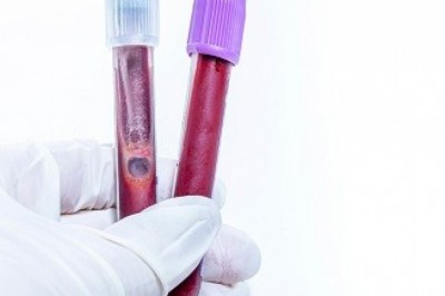 Blood Collection: Crucial Step to Diagnose