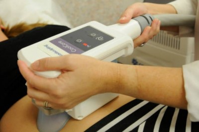 Does coolsculpting really work