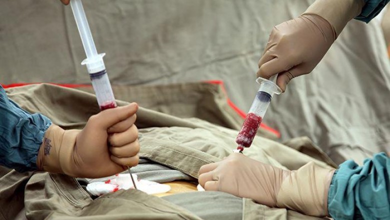 Bone Marrow Transplant Market Size, Trends, Shares and Insights