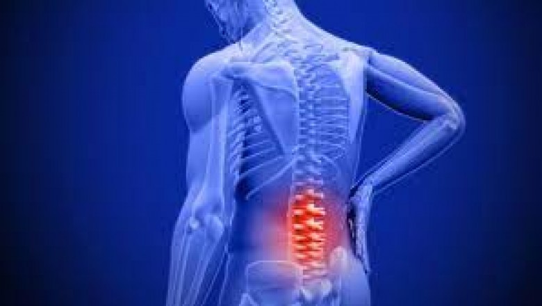 Treatment For Low Back Pain New York