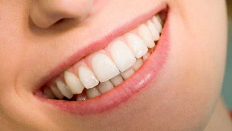 Teeth Whitening: How To Get A Delightful Smile?