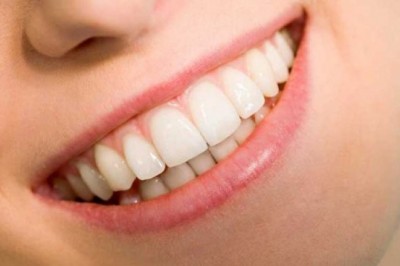 Teeth Whitening: How To Get A Delightful Smile?