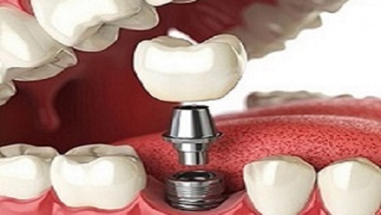 Periodontist Near Me