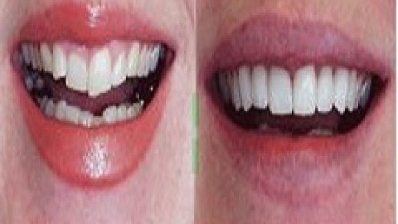 Dentist Norfolk